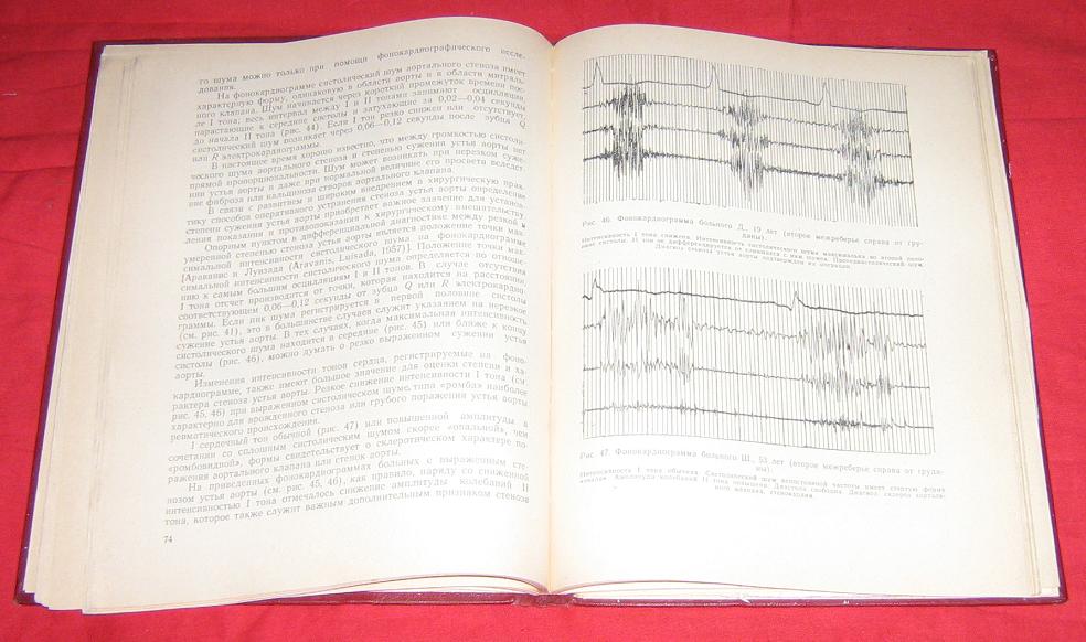 Приобретенные пороки сердца (приложение к книге: Л.М.Фитилева. Краткое руководство по фонокардиографии)